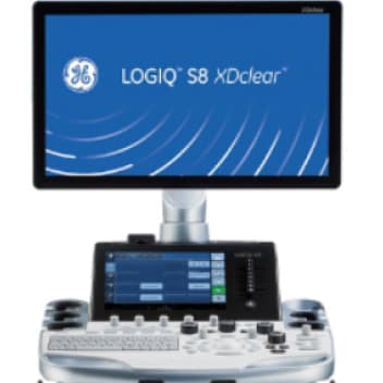 超音波検査機器